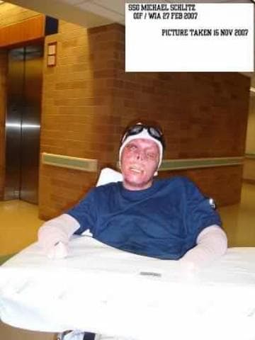 Mike facial reconstruction